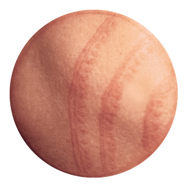 photo of virus v03-100714