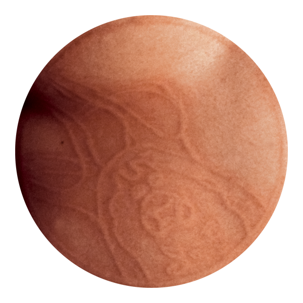 photo of virus v06-011215